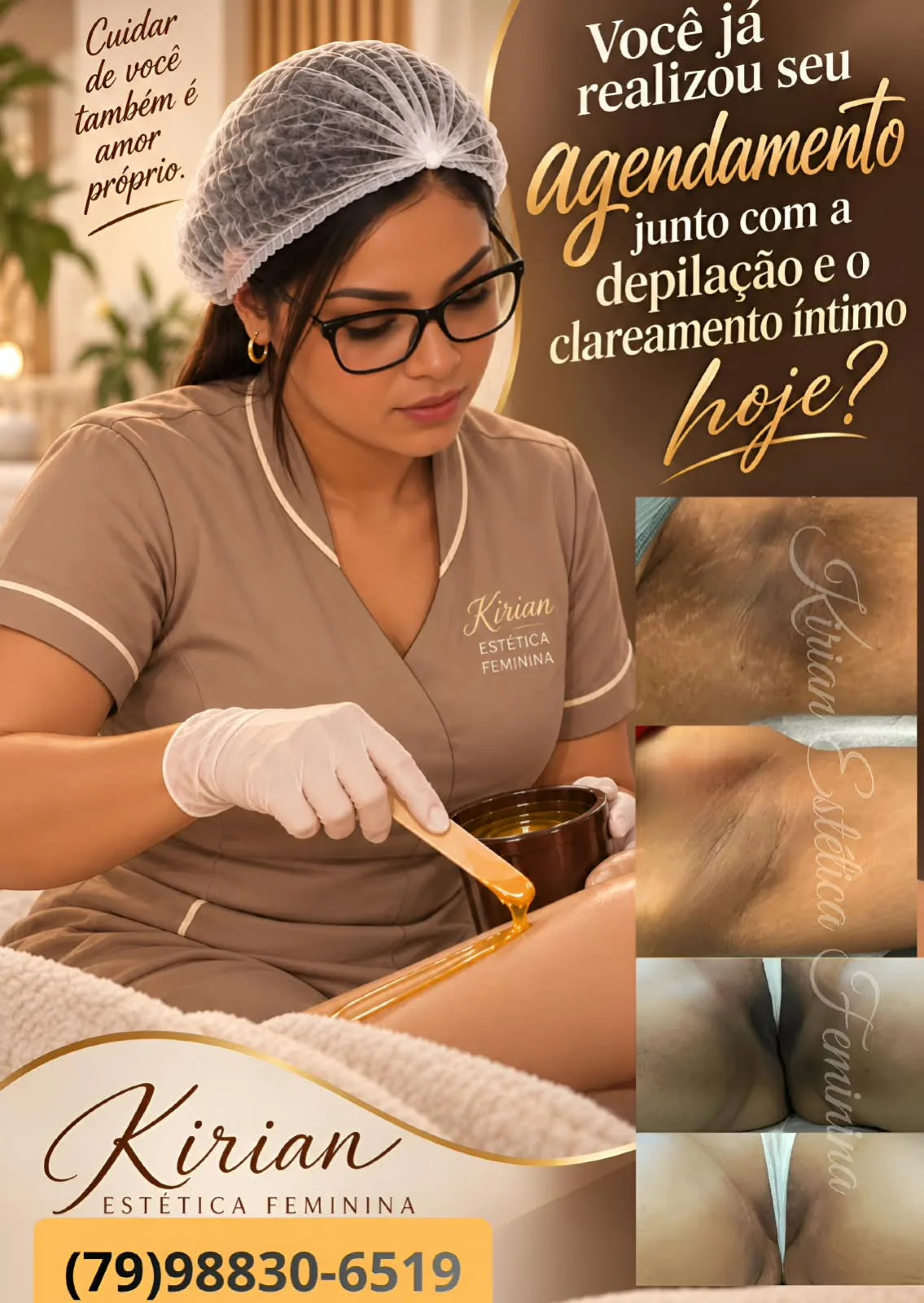 Foto 1 de Depilação e Clareamento Íntimo - Kirian Estética Feminina