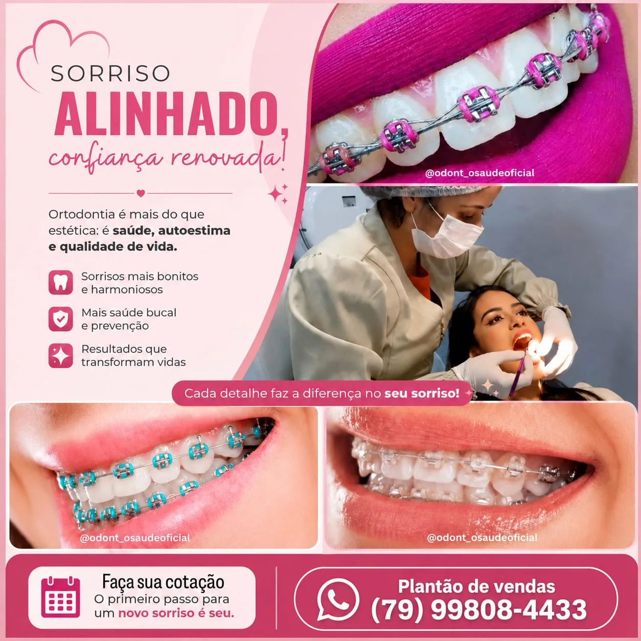 Foto do anúncio SORRISO ALINHADO